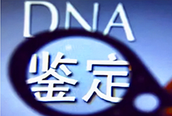 台州DNA鉴定去哪里
